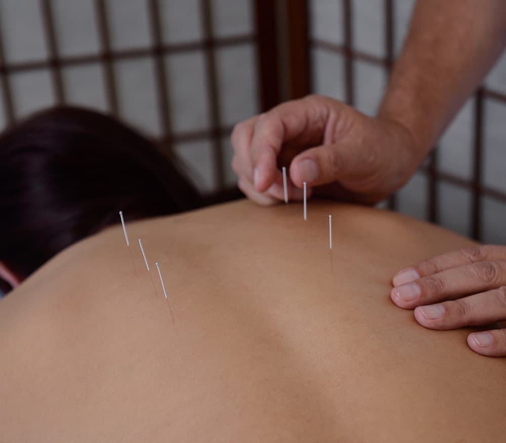 Leighton Buzzard Acupuncture